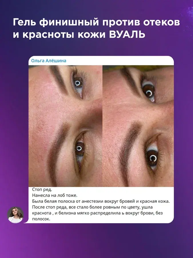 Успокаивающий гель против отёков и красноты кожи после процедуры #617 "Вуаль"