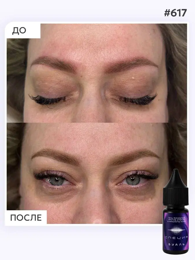 Успокаивающий гель против отёков и красноты кожи после процедуры #617 "Вуаль"