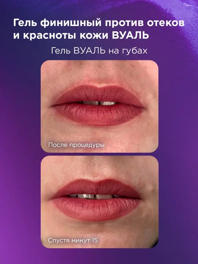 Успокаивающий гель против отёков и красноты кожи после процедуры #617 "Вуаль"